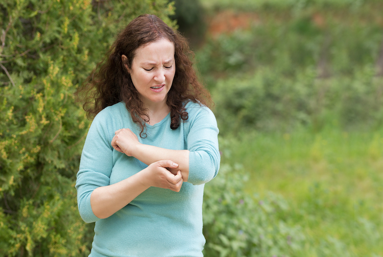 A woman standing outside scratches a bug bite on her arm 